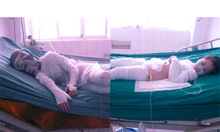 Bị cấm yêu bé 10 tuổi, tạt a-xít cả nhà