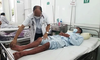 Sốt xuất huyết Dengue: Nguy kịch vì chủ quan
