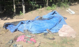 Sét đánh 18 người, 9 cháy sém, nhập viện