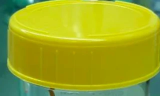 Tăm xỉa răng dài 6cm đâm thủng ruột bé trai 14 tuổi