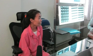 Bệnh nhân có khối u khổng lồ đã ổn định sức khỏe 