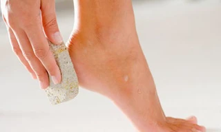 Vì sao tay, chân bị cước khi trời lạnh?