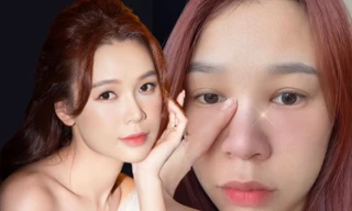 Sam tiết lộ tình trạng sức khỏe đáng quan ngại, nhan sắc đứng trước nguy cơ bị ảnh hưởng