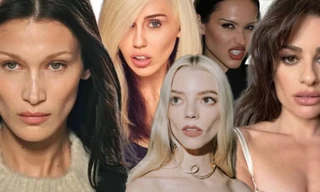 Sao Âu Mỹ sau thủ thuật lấy mỡ má: Bella Hadid nâng tầm nhan sắc, Liam Payne khác lạ