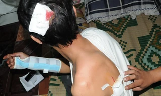 Hai người bị chém tại tiệc cưới