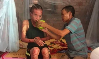 Trường ĐH Văn Hiến kêu gọi ủng hộ cho sinh viên bị bệnh nặng