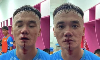 VFF phạt nặng hai cầu thủ đánh nhau ở giải hạng Nhất 