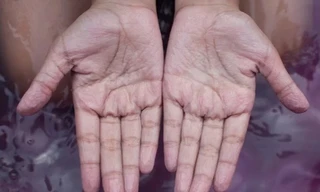 Lý do ngón tay bị nhăn khi ngâm nước