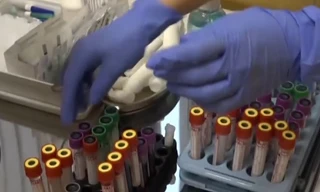 Hàng nghìn người cấy chip vào cơ thể để sống lâu hơn, khỏe hơn