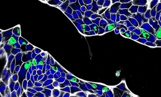 Phát hiện ra vi khuẩn đường ruột khiến nhiễm trùng tái phát ở vùng sinh dục