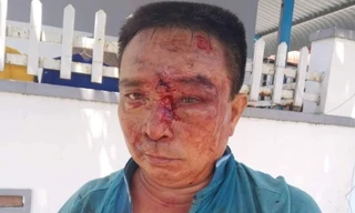 Tài xế, phụ xe khách đánh người đàn ông dã man vì mâu thuẫn gửi hàng