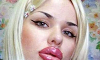 Bơm môi để giống nhân vật hoạt hình