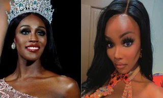 Sau khi bị 'biến dạng' vì thẩm mỹ, Hoa hậu chuyển giới 2019 khoe diện mạo mới khó nhận ra