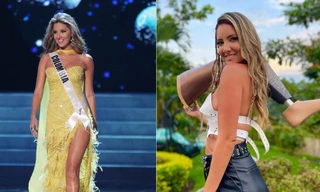 Nghị lực phi thường của Hoa hậu Hoàn vũ Colombia từng phải cắt bỏ chân trái