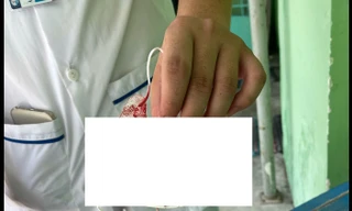 Nữ sinh viên gọi người yêu tới đánh bạn cùng lớp nhập viện