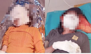 Điện thoại phát nổ khiến 2 vợ chồng bỏng nặng