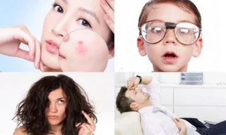 Những dấu hiệu bất thường cảnh báo cơ thể bạn đang thiếu vitamin nghiêm trọng