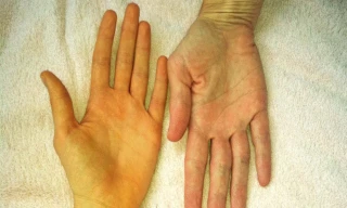 Những dấu hiệu cho thấy gan đang nhiễm độc, cần được 'thanh lọc' gấp