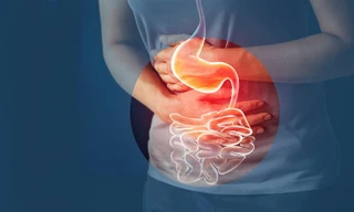 Những thực phẩm người đau dạ dày nên tránh tuyệt đối kẻo rước thêm bệnh vào thân