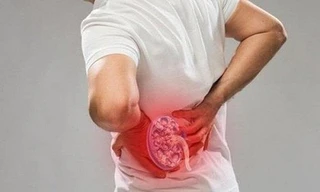 Phát hiện nguy cơ suy thận qua những dấu hiệu bất thường khi đi tiểu