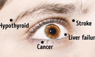 Từ bệnh tiểu đường, bệnh gan đến đột quỵ, u não… có thể được phát hiện qua đôi mắt. Ảnh SHUTTERSTOCK