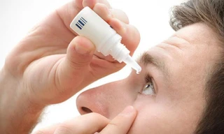 Không sử dụng chung thuốc nhỏ mắt hay dùng quá nhiều trong một lần sử dụng