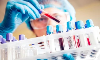 Ảnh minh họa: Internet