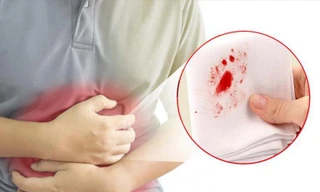 Bất ngờ chảy máu từ những vị trí này, rất có thể bạn đã bị ung thư