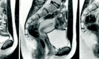 Làm 'chuyện ấy' trong máy chụp cộng hưởng từ và những bức ảnh chấn động 