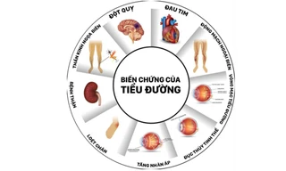 Tìm được độ tuổi khám phát hiện nguy cơ mắc tiểu đường sớm, giảm biến chứng