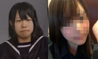 Một nữ sinh trung học bị bắt nạt vì xấu xí, trải qua 4 lần phẫu thuật và cái kết bất ngờ