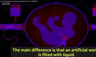 Sắp có tử cung nhân tạo để nuôi sống trẻ sinh non