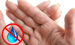 Bất thường ở bàn tay tiết lộ gì về sức khỏe?