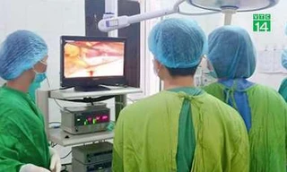 Lạm dụng thuốc giảm đau, người đàn ông ở Hà Giang bị thủng dạ dày