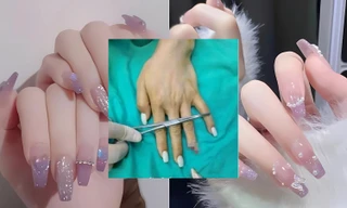 Sơn móng quá dày, người phụ nữ ở Trung Quốc bị đứt ngón tay vì mất cảm giác