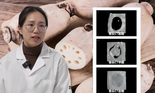 Thực hư chuyện các "pháp sư Trung Hoa" dùng củ sen tái tạo cơ thể như Na Tra