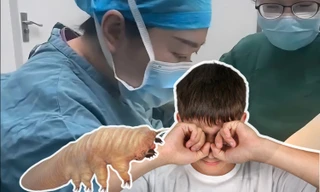 Trung Quốc: Dụi mắt cho "đã", hơn 80 con ve "làm tổ" trong mắt cậu bé 13 tuổi
