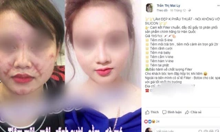 Tiêm filler: Sau công dụng 'thần tiên', làm nhanh giá rẻ là ẩn họa khôn lường!