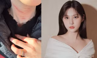 Bạn trai cũ Kim Sae Ron tiết lộ cô thường bị bạo hành, gia đình phớt lờ, độ tin cậy tới đâu?