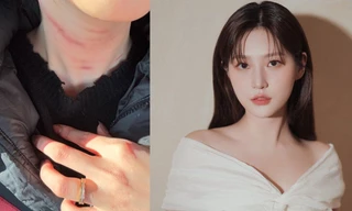 Bạn trai cũ Kim Sae Ron tiết lộ cô thường bị bạo hành, gia đình phớt lờ, độ tin cậy tới đâu?