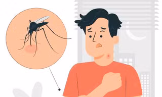 Dịch sốt xuất huyết tăng cao, lưu ý ngay những dấu hiệu nhận biết và cách phòng tránh