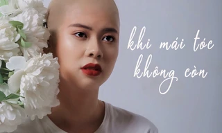 Dự án “Khi mái tóc không còn“
