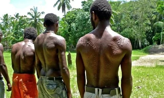 Bộ tộc bé trai phải chịu đau đớn chết người khi bị rạch da để giống vảy cá sấu