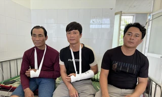 Ngư dân Nguyễn Thanh Biên (bìa phải) thuyền trưởng tàu cá QNg 95739 TS, bị đánh với nhiều vết bầm trên người. Ảnh: NN