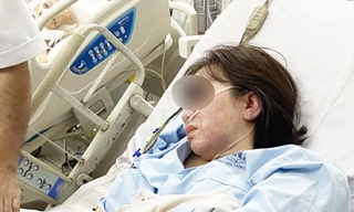 Bệnh nhân bị nổi mẩn đỏ, phù toàn thân, sốc phản vệ độ 3 sau tiêm vắc xin. Ảnh: BVCC