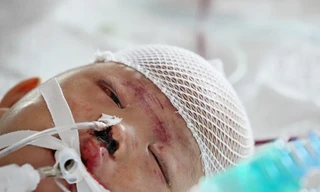 Bé gái hai tuổi bị xe tải đâm đang hồi phục