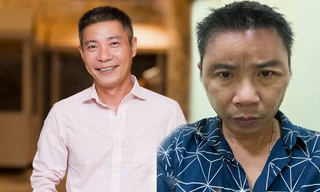 'Hốt hoảng' trước gương mặt sưng vù của NSND Công Lý 