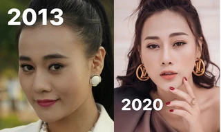 Phương Oanh chia sẻ quá trình 'lột xác' với nhan sắc hiện tại sau phẫu thuật thẩm mỹ