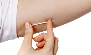 Tránh thai hiện đại, biện pháp nào phù hợp với bạn? 