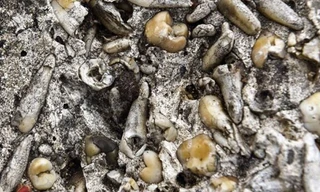 Kì lạ khối bê tông chứa hàng nghìn chiếc răng người